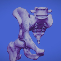 MALE PELVIS, SACRUM, ILIAC, COXIS, 5 LUMBAR
