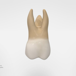 Maxillary First Molar with Cusp of Carabelli