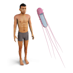 Typhoid