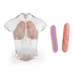Tuberculosis