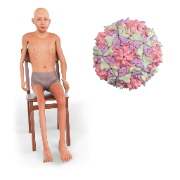 Polio