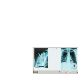 medical_xray_image_viewer__200_uploads