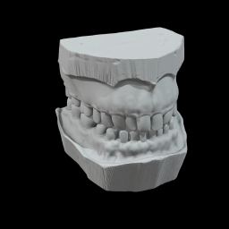 Dental Impression