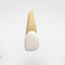 Maxillary Lateral Incisor