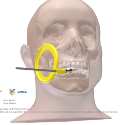 Dental Intra Orl X-ray Positioner, Periapical