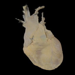 Perfusion Fixed Human Heart #486