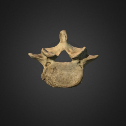 Fifth Lumbar Vertebra