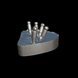 Implant-denture