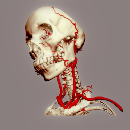 Arteries of head  neck