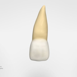 Maxillary Left Central Incisor