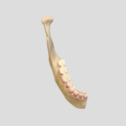 Post-mortem Pink Teeth