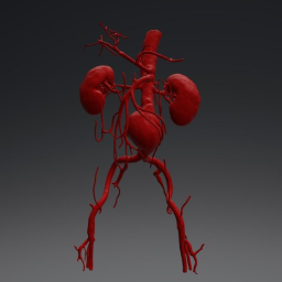 Abdominal aorta aneurism