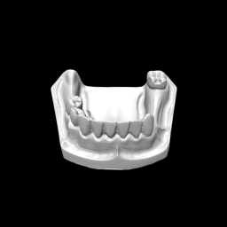 RPD Exercise: Modified dentoform - Preview