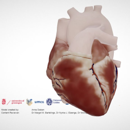 Normal Neonatal Heart