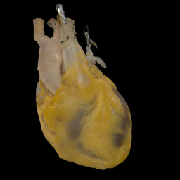 Perfusion Fixed Human Heart Anatomical Model