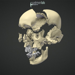 Visible Interactive Human - Exploding skull