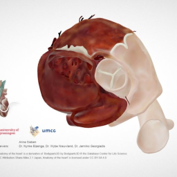 Cardiac Anatomy: PSAX Aortic Valve echo plane