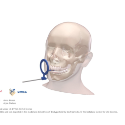 Dental Intra Oral X-ray Pos - empty annotation