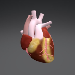 Heart- Whole